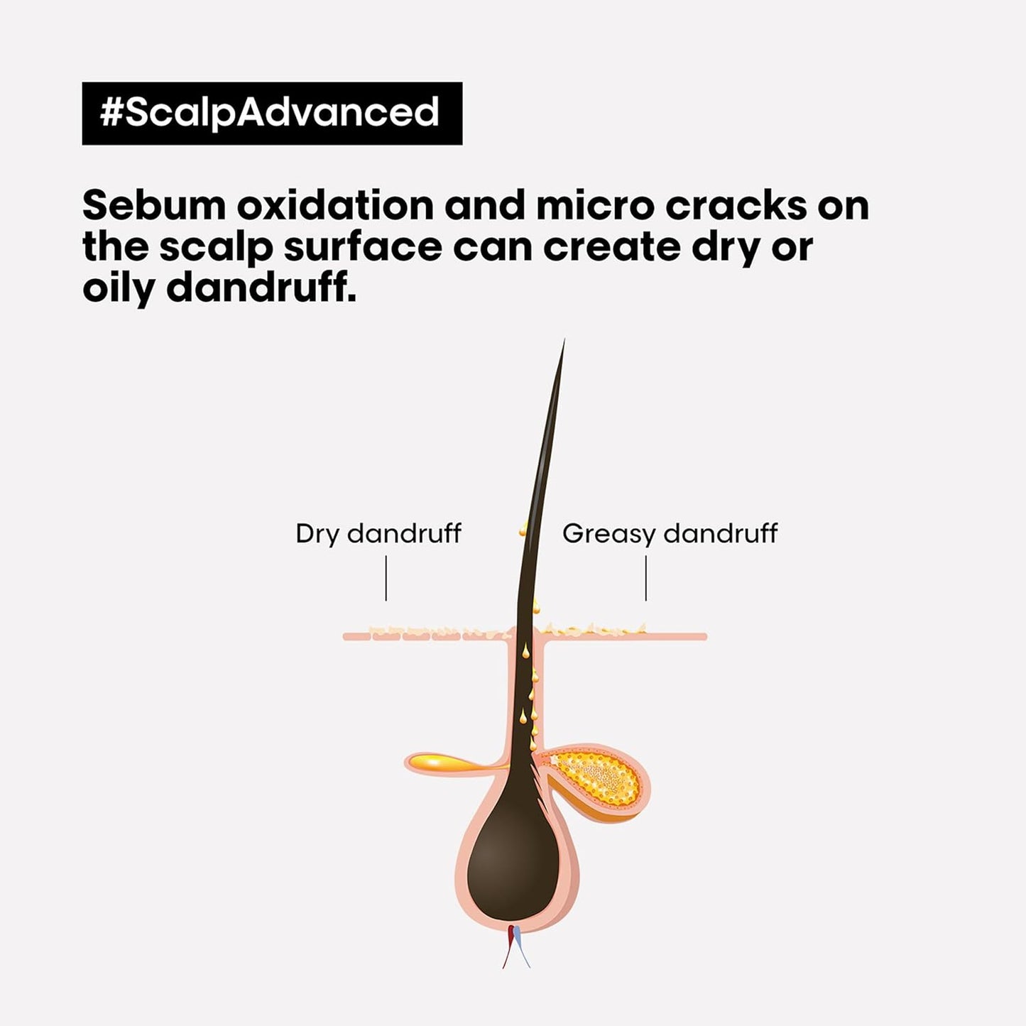 L'Oréal Professionnel Scalp Advanced Anticaspa Dermo-Clarificador Shampoo